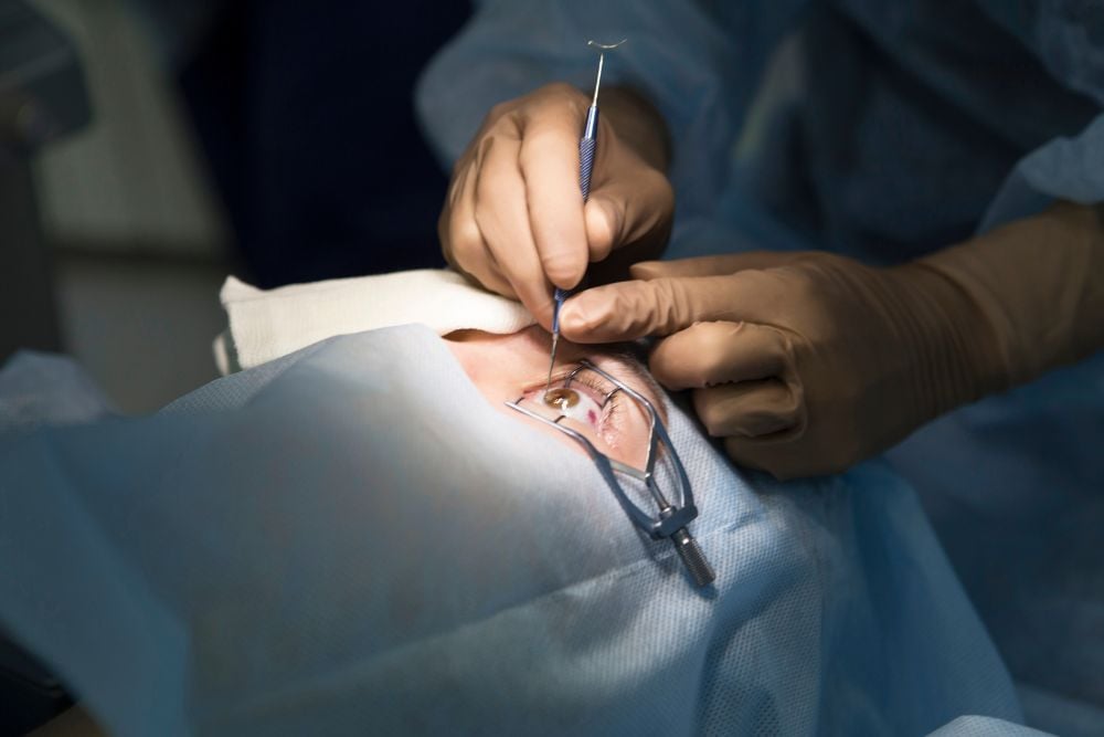 Corneal Transplant (keratoplasty) Surgery Cost Dubai Eye Clinic